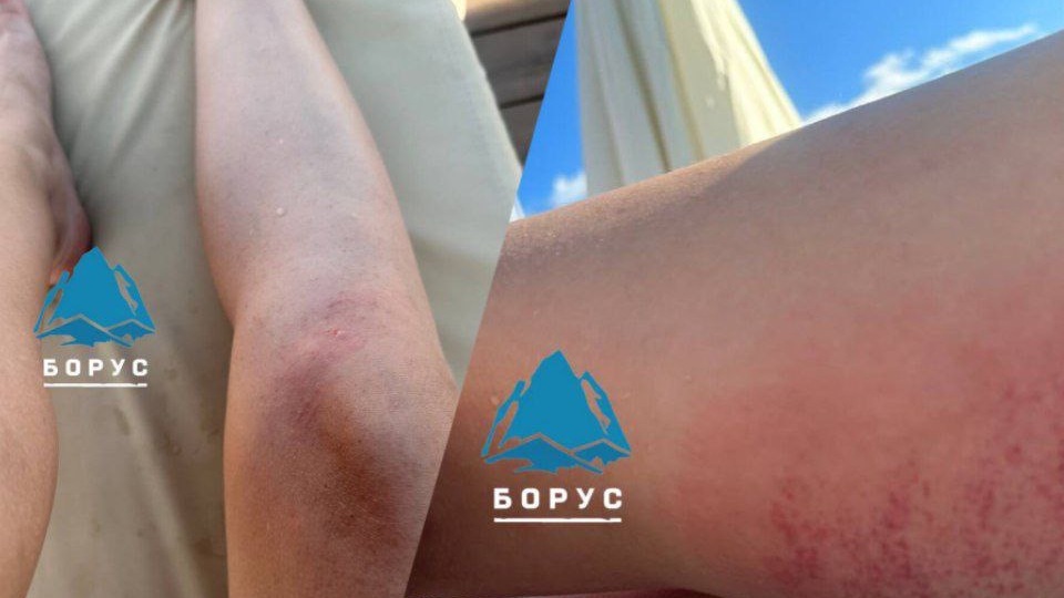 Красноярка упала в слив для воды у бассейна в Емельяново и повредила ноги
