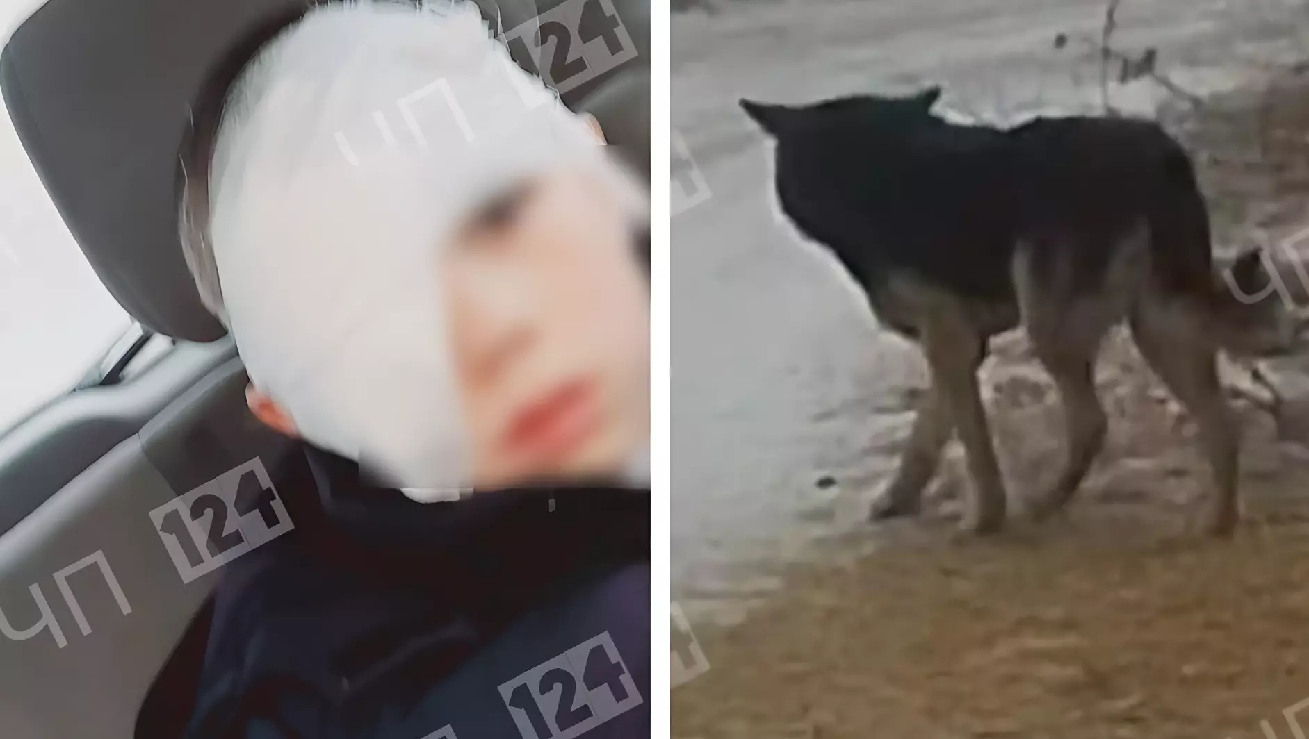 В крае бродячая собака разодрала лицо мальчику и повредила глаз