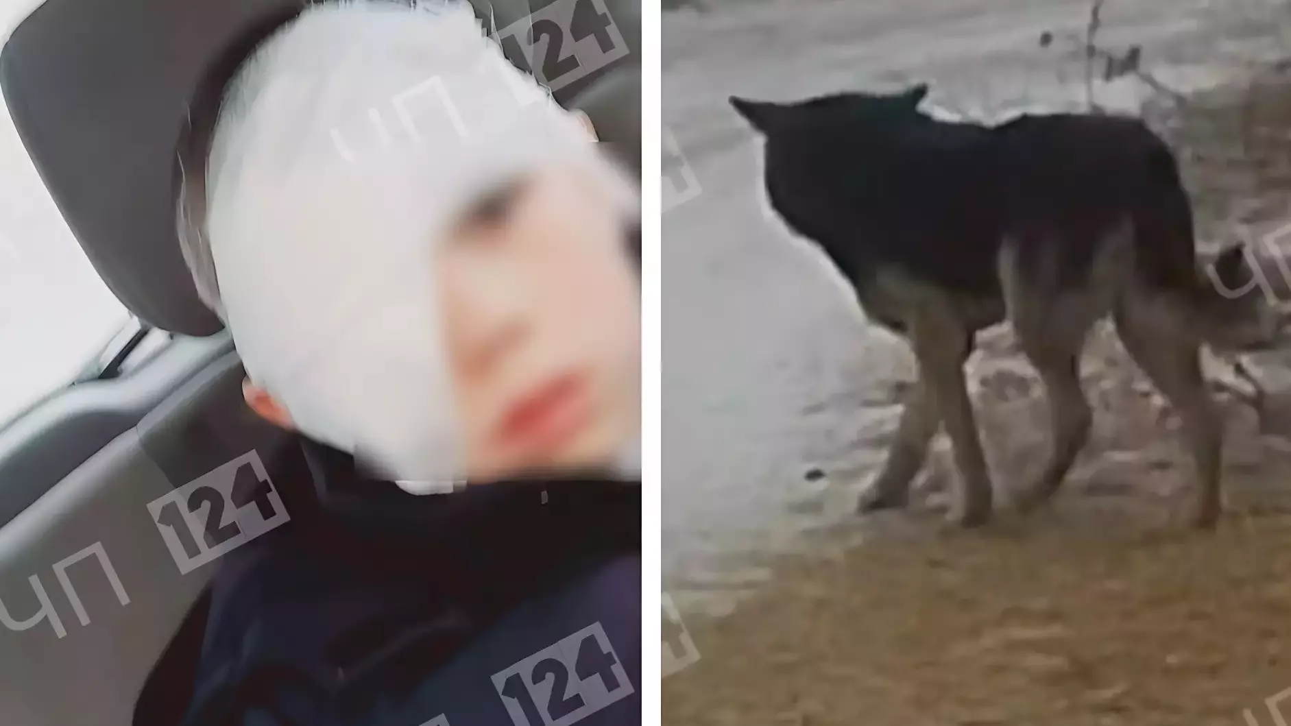 Одноклассник спас мальчика, которому собака раздирала глаз
